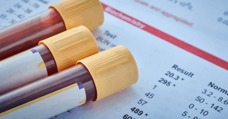 an image of 3 blood vials for an article on NHS blood test delays